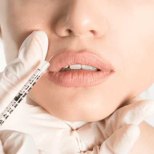 Woman having filler injected into her lips